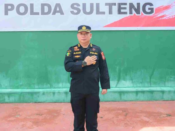 Bakti Kesehatan Hari Bhayangkara Ke-78: Polda Sulteng Gelar Operasi Celah Bibir dan Lelangit Gratis